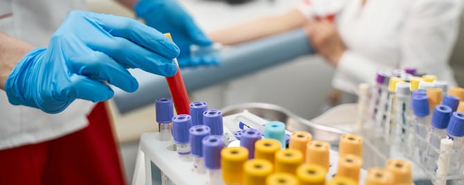 Know Your Tools: Hormonal Diagnostics for Fertility, PCOS & Menopause