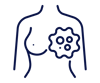 Oncology_Breast