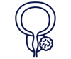 Oncology_Prostate